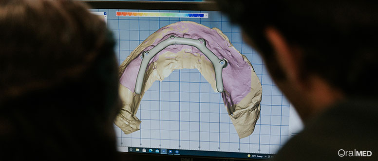 Mercado de proteses dentarias - tecnologia CAD-CAM